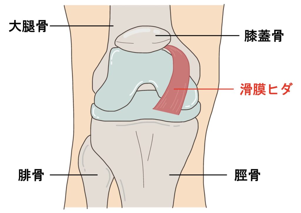 ひざの棚障害：膝が痛い人が棚障害になって八広駅前整骨院で整体・マッサージ治療を受けるイラスト